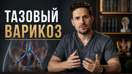 Тазовый варикоз 👉 {СКОРО В ПРОДАЖЕ}